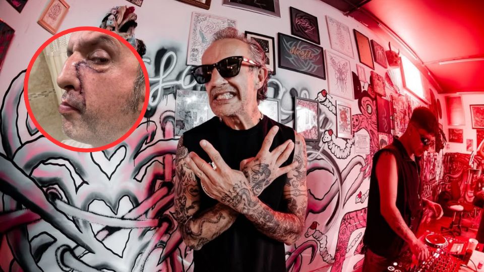 La cirugía reconstructiva forma parte de un proceso prolongado enfocado en la recuperación del músico.