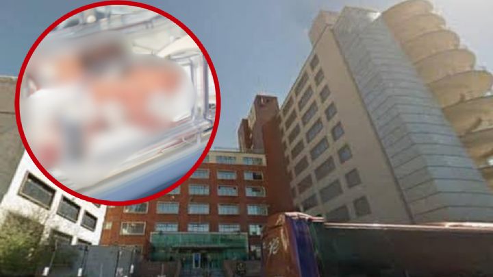 Descuido termina en horrible accidente: bebé lucha por su vida tras caerle plato de sopa caliente