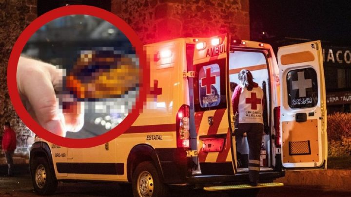 Vecino ebrio ataca a botellazos a jovencita de 16 años; le dejó heridas en la cara y sin 2 dientes